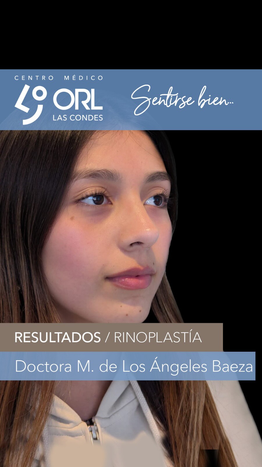 Un gran cambio para partir el día y felices con el resultado!! 🤗
ORL Las Condes es ese espacio donde el paciente puede confiar plenamente los cuidados de su salud en las manos de otorrinos expertos. Atendemos y asesoramos a pacientes que valoran la experiencia y que buscan atención personalizada.
📍Centro Médico ORL las Condes en Estoril 200, Oficina 723, Las Condes, Santiago de Chile
Teléfono: +56 2 2480 1700
Whats app: +56 9 8846 5438
Mail: secretaria@orl-lascondes.cl
WEB: www.orl-lascondes.cl
⚠️ Los comentarios ofensivos o discriminatorios serán eliminados/bloqueados para proteger la integridad del paciente.
⚠️ Los resultados de cada paciente son únicos y dependen de sus antecedentes, tipo de piel, cirugía/técnica, cicatrización/recuperación y cuidados postoperatorios.
#rinoplastía #rinoseptoplastía #rinoplastíaultrasonica #rinoplastiaestetica #rhinoplasty #cirugiaestetica #rinoplastiasantiago #rinoplastíafuncional #reconstrucciónnasal #orl #otorrinolaringología #nariz #antesydespués
