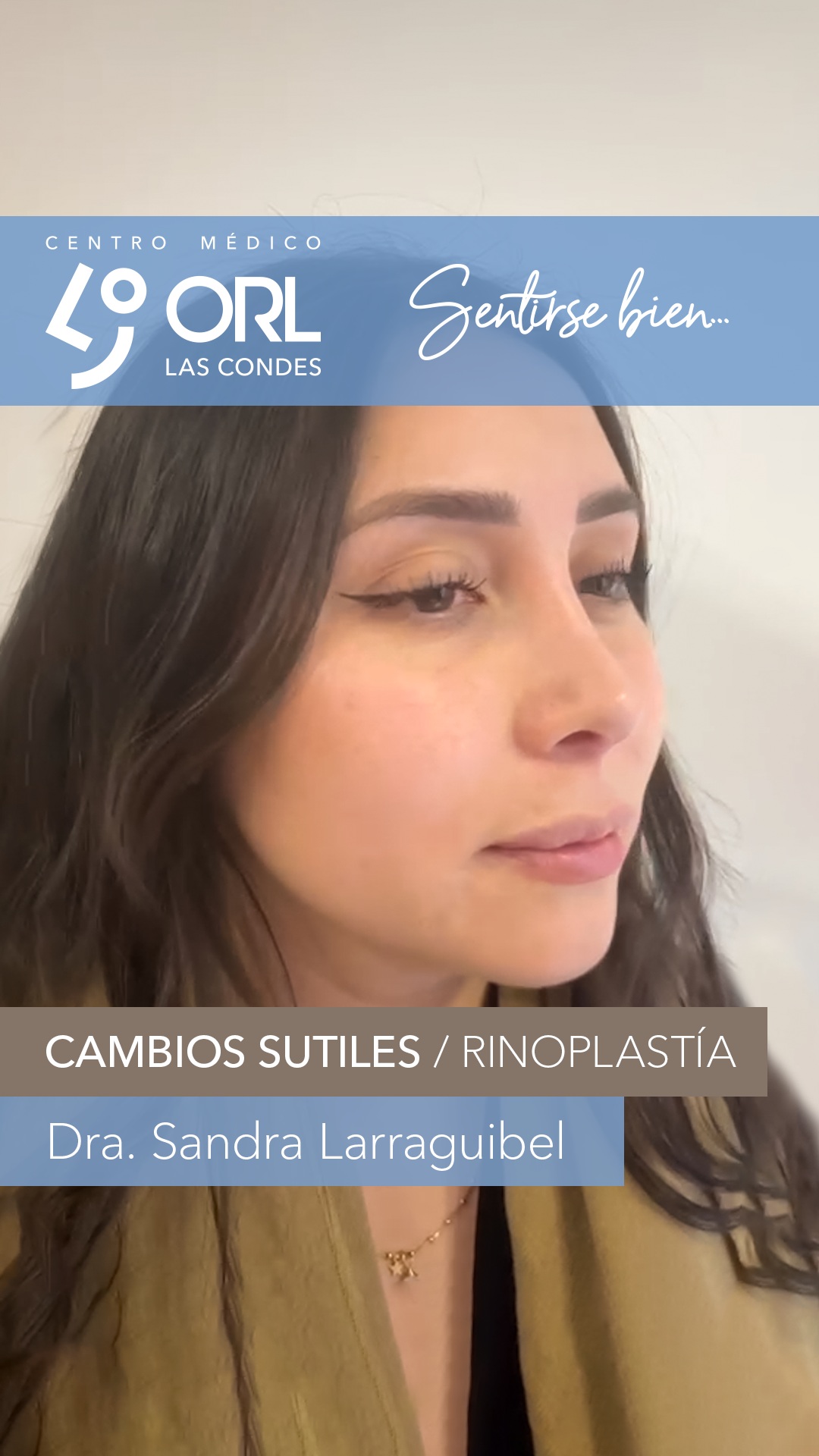 Hay perfiles que requieren solo detalles. Detalles que te hacen brillar 🤗
Que vuelvas a Sentirte bien es nuestro compromiso!
Agenda una hora en el Centro Médico ORL las Condes en Estoril 200 oficina 723, Las Condes, Santiago
Teléfono: +56 2 2480 1700
Whats app: +56 9 8846 5438
Mail: secretaria@orl-lascondes.cl
WEB: www.orl-lascondes.cl
#rinoplastía #rhino rhinoplasty #rinoseptoplastía #rinoplastiachile #rinoplastiasantiago #rinoplastiaestetica #rinoplastía #rhinoplasty #rinoseptoplastía #rinoplastiachile #rinoplastiasantiago #rinoplastiaestetica #cirugiaestetica #rinoplastíaestética #rinoplastíafuncional #surgery #reconstrucciónnasal #orl #otorrinolaringología #nariz #otorrino