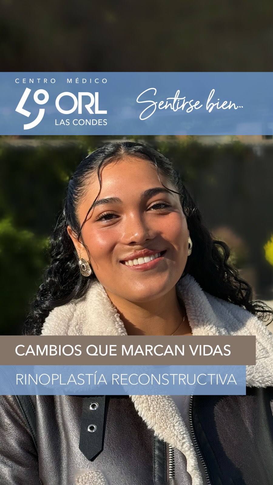 Queremos compartirles los resultados que obtuvimos con esta querida paciente.
Antonia es portadora de una fisura labio-palatina bilateral operada en múltiples ocasiones. Tenía una desviación septal, cornetes hipertróficos, una concha bulosa y era espiradora bucal.
Había sido operada por cirujanos plásticos. Sin embargo, tenía una nariz muy ancha, con muy poca proyección y definición en la punta.
El Dr. Ernesto Ried y la Dra Angeles Beza le hicieron una rino septoplastía estructurada con injerto costal para lograr una nariz más grande, de líneas más marcadas y por donde pudiera respirar con normalidad.
Gracias Antonia por permitirnos compartir tus lindos resultados.
Que vuelvas a Sentirte bien es nuestro compromiso!
🗓️ Agenda hoy tu visita por telemedicina o presencial, para una evaluación.
Centro Médico ORL las Condes en Estoril 200, Oficina 723, Las Condes, Santiago de Chile
Reserva de horas:
Teléfono: +56 2 2480 1700
Whats app: +56 9 8846 5438
Mail: secretaria@orl-lascondes.cl
WEB: www.orl-lascondes.cl
• Los comentarios ofensivos o discriminatorios serán eliminados
#plastía #septoplastía #rinoplastíaultrasonica #rinoplastiaestetica #rhinoplasty #cirugiaestetica #rinoplastiamaculina #rinoplastíafuncional #reconstrucciónnasal #orl #otorrinolaringología #nariz #antesydespues